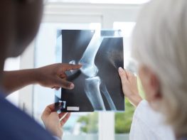 Fluid On the Knee X-ray; Diagnosis for Knee Effusion