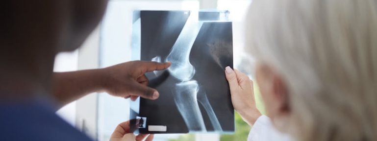 Fluid On the Knee X-ray; Diagnosis for Knee Effusion